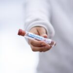 Soa test: hoe werkt het en wanneer moet je je laten testen?