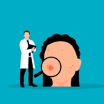 Acne crème: werking, soorten en tips voor gebruik